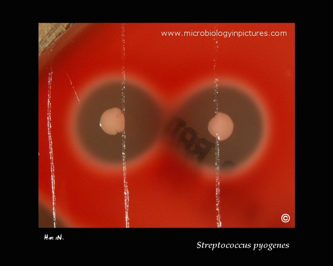 streptococcus pyogenes and hemolysis of erythrocytes on blood agar